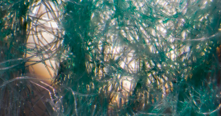 photomicroscopy photomicrograph micrograph